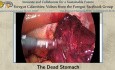 L'Estomac Mort - The Dead Stomach 