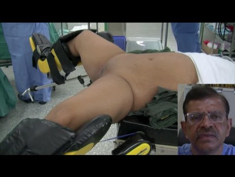 Trucs et astuces pour effectuer une chirurgie par laparoscopie - préparation du patient à la chirurgie laparoscopique