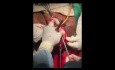 Colpocléisis de LeFort (Dr Wedisha Gankanda)