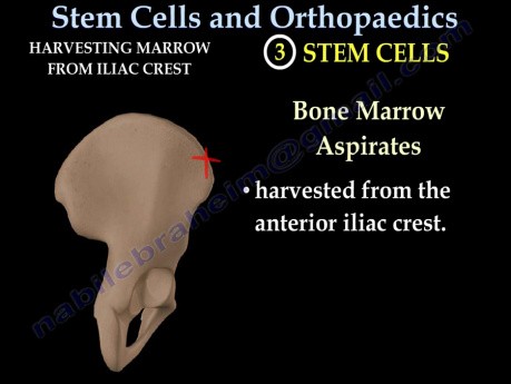 Cellules souches en orthopédie - Conférence vidéo