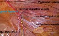 Repères dans l'Exploration Laparoscopique des Hernies TAPP