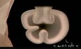 Gastroplastie transorale (TOGA)