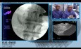 Anastomose hépatico-gastrique sous le contrôle de l'échographie endoscopique (EUS)