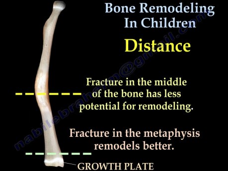 Remodelage osseux chez les enfants