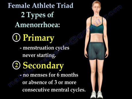 Triade d'athlètes féminines