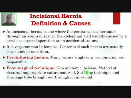 Hernie abdominale