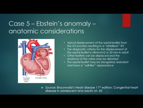 Apprentissage à travers des cas cliniques sur les Cardiopathies Congénitales et les Shunts