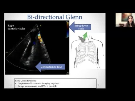 Éponymes et Echocardiographie : l'Imagerie des Réparations Chirurgicales Congénitales Complexes