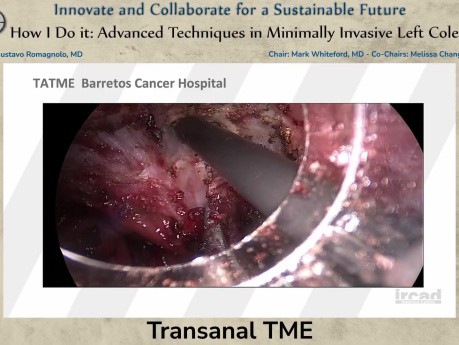  TME Transanale