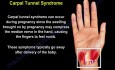 Causes et traitement de la douleur au poignet - Partie 1