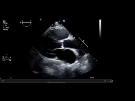 Un Aperçu sur le Passé de l'Echocardiographie - Les Personnages Derrière les Noms