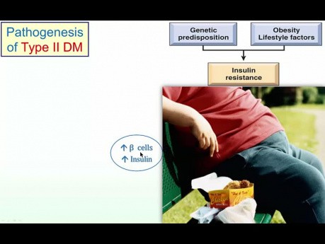 La pathogenèse du diabète de type 1 et 2